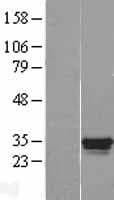 GATAD1 Protein (Over-Expression Lysate Myc-DDK (Flag))