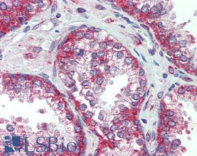 IHC-plus™ PURA / Pur-Alpha Antibody (aa100-150)