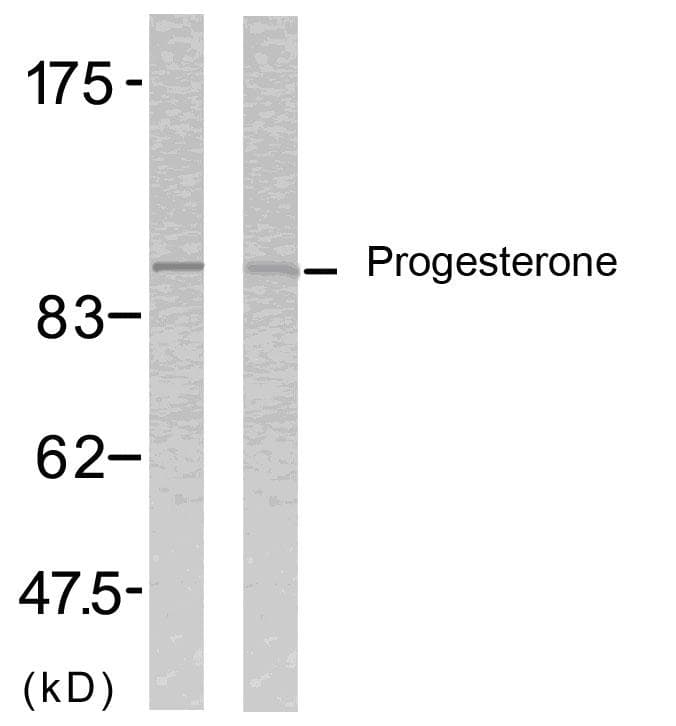 Polyclonal Rabbit anti-Human PR / Progesterone Receptor Antibody (p190, WB)