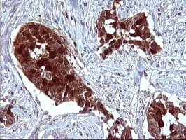 SERPINB3 Antibody (clone OTI1G5)