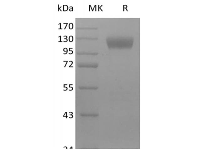Mouse SIGLEC10 Protein (Recombinant Fc, C-terminus)