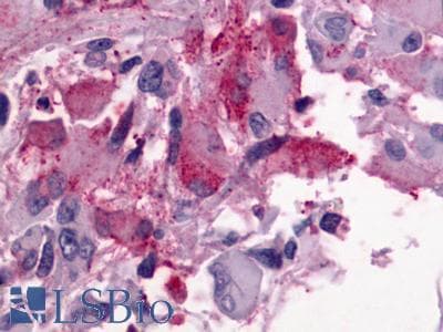 PathPlus™ Polyclonal Rabbit anti-Human GPR176 Antibody (C-Terminus, IHC)