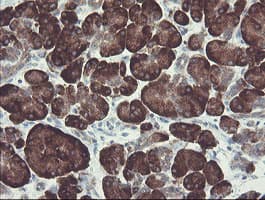 Monoclonal Mouse anti-Human GORAB / SCYL1BP1 Antibody (clone OTI1E3, aa35-394, IHC, WB)