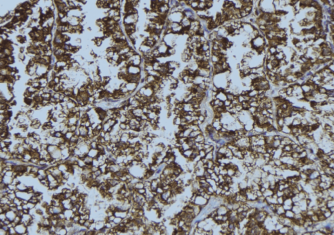 DDX58 / RIG-1 / RIG-I Antibody