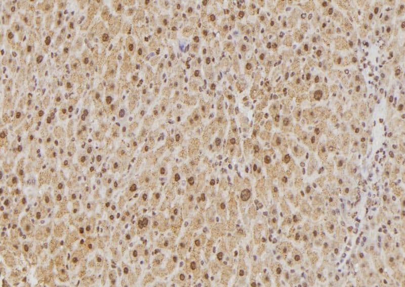PPP1CB Antibody