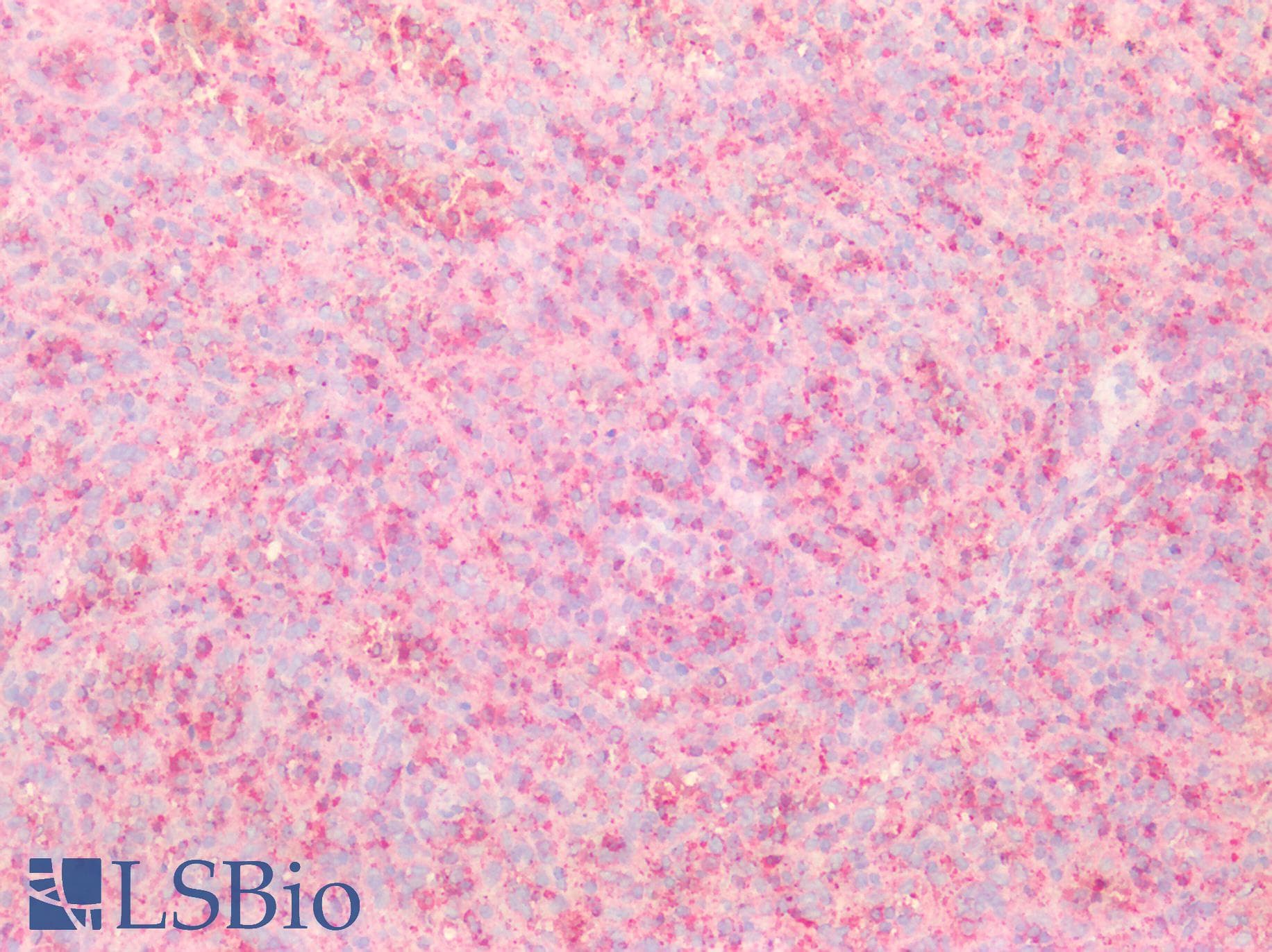 PTPN2 / TC-PTP Antibody