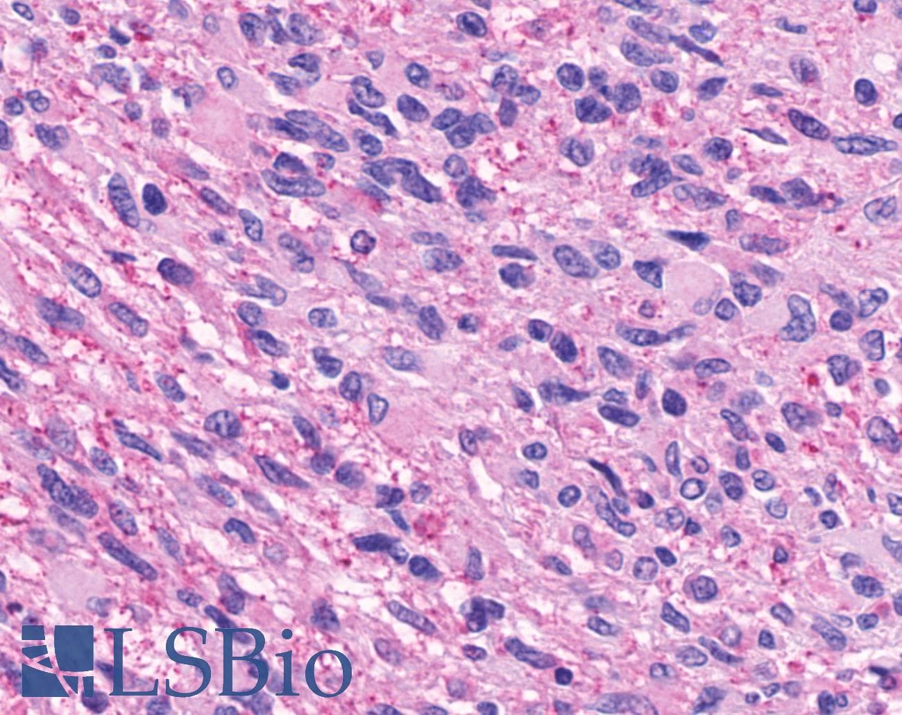 IHC-plus™ NPFF2 / NPFFR2 Antibody (Extracellular Domain)