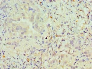 Polyclonal Rabbit anti-Human PAX6 Antibody (aa1-300, IHC)