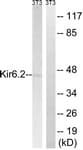 IHC-plus™ Polyclonal Rabbit anti-Human KCNJ11 / Kir6.2 Antibody (aa190-239, IHC, IF, WB)
