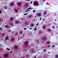Polyclonal Rabbit anti-Human LPAR3 / LPA3 / EDG7 Antibody (C-Terminus, IHC, WB)