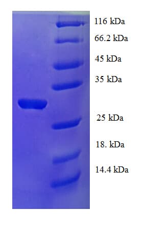 Human PDRG1 Protein (Recombinant His-SUMO)