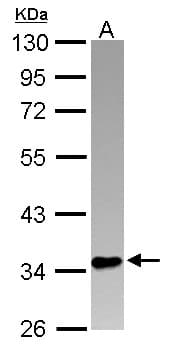 Polyclonal Rabbit anti-Human PINX1 Antibody (WB)