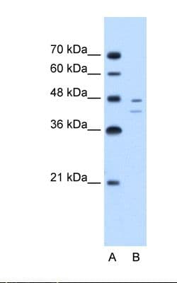 Polyclonal Rabbit anti-Human FAH Antibody (FITC, aa311-360, IHC, WB)