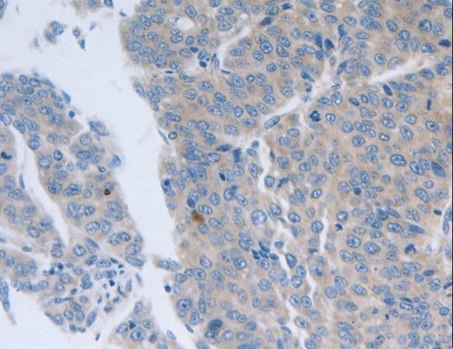 Polyclonal Rabbit anti-Human GRIN1 / NMDAR1 Antibody (IHC)
