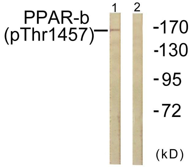 MED1 / TRAP220 Antibody (phospho-Thr1457)