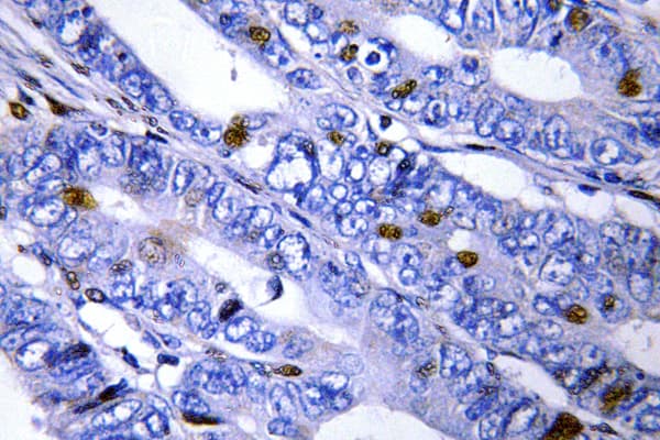 PRKAR2B Antibody (Thr109)
