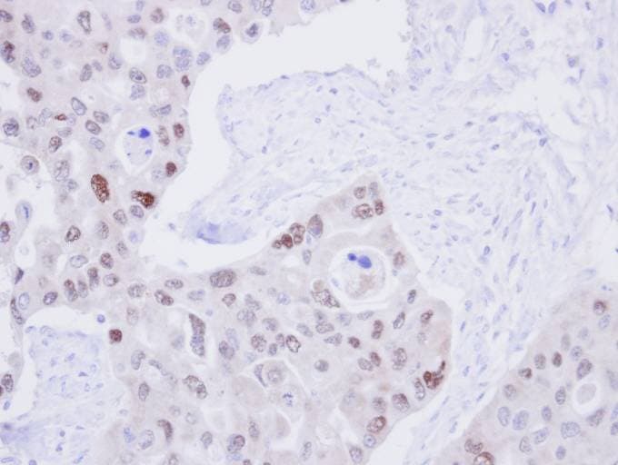 LIG3 / DNA Ligase III Antibody (aa765-1009)