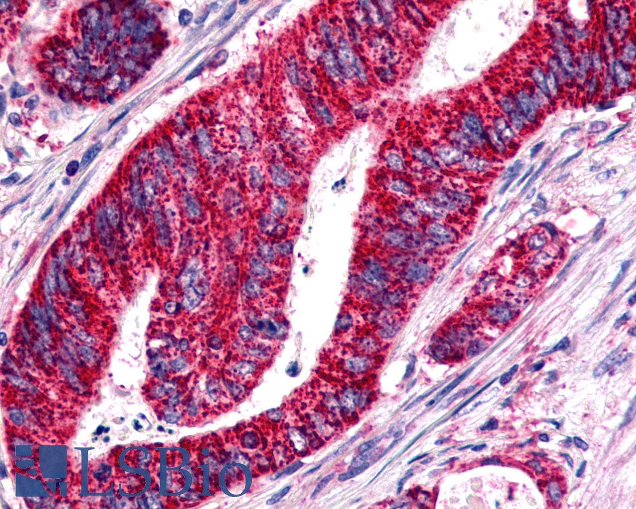 PathPlus™ BOB / GPR15 Antibody (Cytoplasmic Domain)