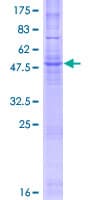 Human CYB561 Protein (Recombinant GST)