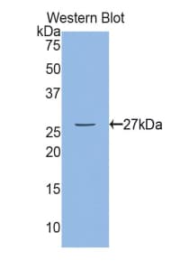 MYLK Antibody (aa1661-1877)