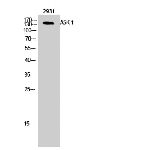 Polyclonal Rabbit anti-Human MAP3K5 / ASK1 Antibody (20-100 aa, IHC, WB)