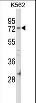 FAM63B Antibody (aa577-606)