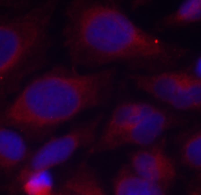 NFKB1 / NF-Kappa-B Antibody (phospho-Ser893)