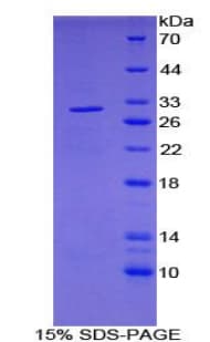 Human PDP1 Protein (Recombinant His-T7)
