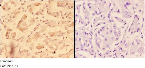ADAM12 Antibody