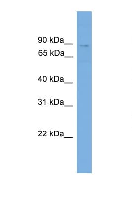 Polyclonal Rabbit anti-Human GLNRS / QARS Antibody (aa215-264, WB)
