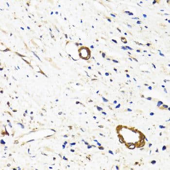 Polyclonal Rabbit anti-Human Vasohibin 1 / VASH1 Antibody (IHC, WB)