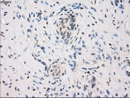 MAP2K1 / MKK1 / MEK1 Antibody (clone OTI1F5)