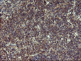 POMC / Proopiomelanocortin Antibody (clone OTI2B2)