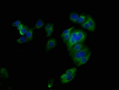 IHC-plus™ Polyclonal Rabbit anti-Human SDC1 / Syndecan 1 / CD138 Antibody (aa23-254, IHC, IF)