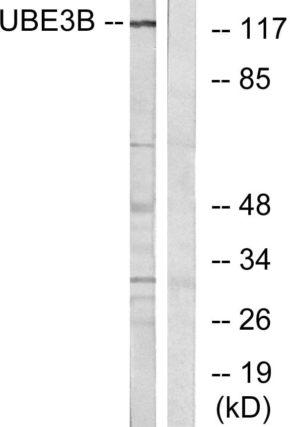 UBE3B Antibody (aa581-630)