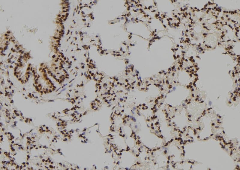 BRAF / B-Raf Antibody
