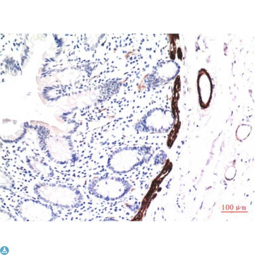 Monoclonal Mouse anti-Human Muscle Actin Antibody (IHC)