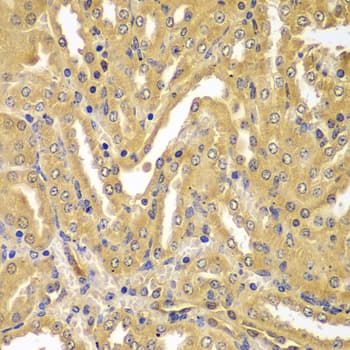 UBE2Z / USE1 Antibody