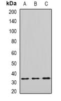 Polyclonal Rabbit anti-Human EIF2B1 Antibody (WB)
