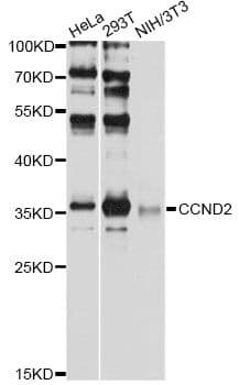 CCND2 / Cyclin D2 Antibody
