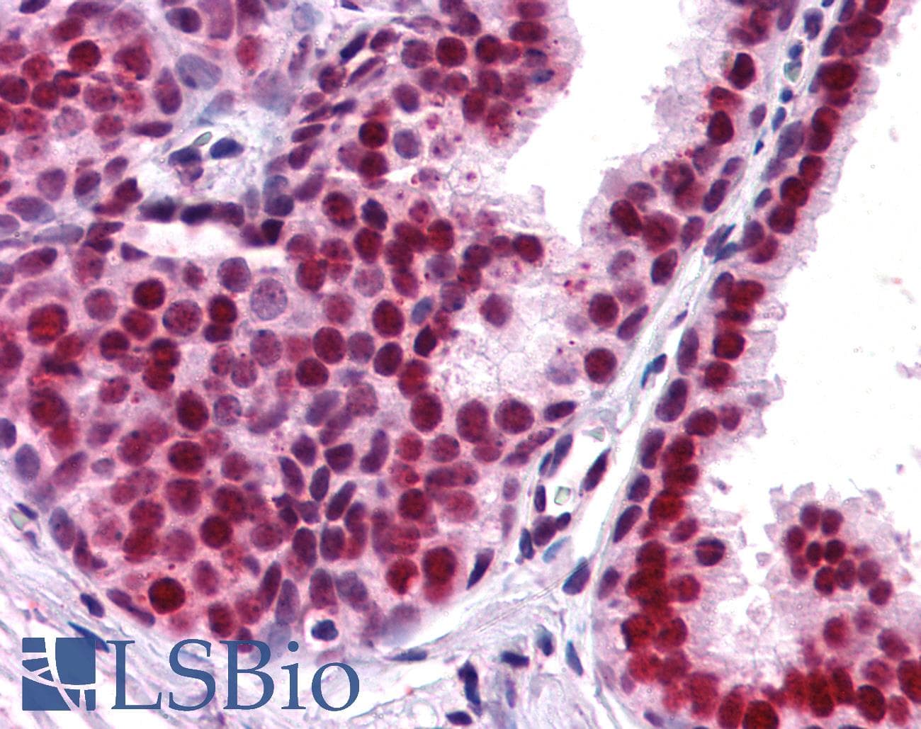 IHC-plus™ APEX1 / APE1 Antibody (aa2-15)