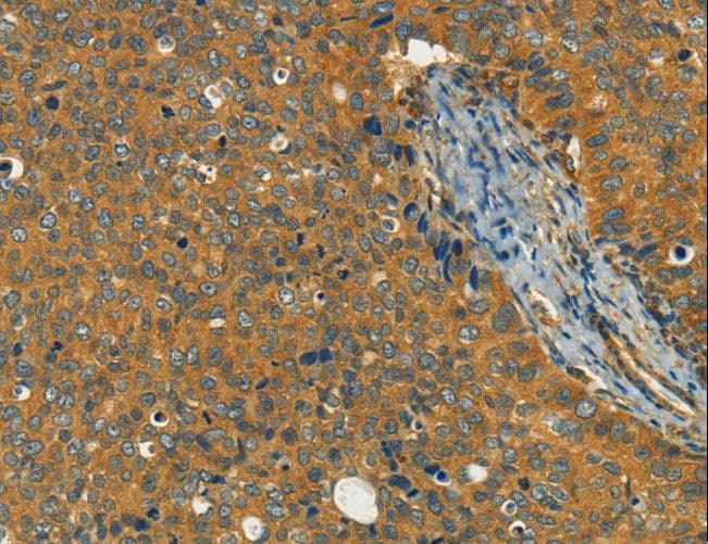 Polyclonal Rabbit anti-Human KLC1 / Kinesin Light Chain 1 Antibody (IHC, WB)