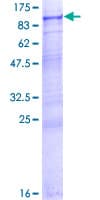 Human INPP5E Protein (Recombinant GST)