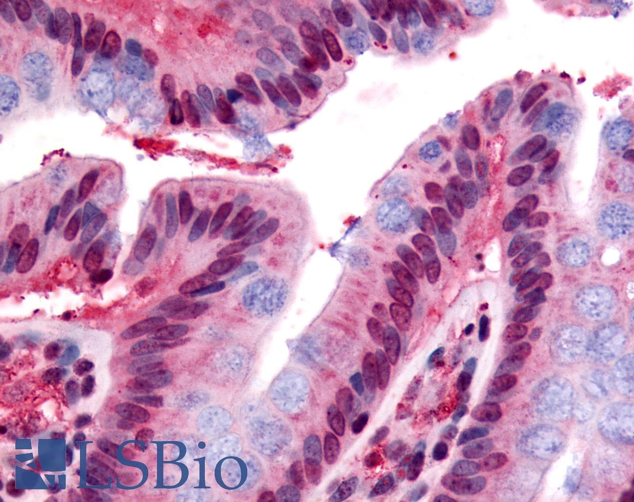 IHC-plus™ Polyclonal Rabbit anti-Human GPR160 Antibody (Cytoplasmic Domain, IHC)