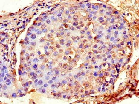 ACTG1 / Gamma Actin Antibody