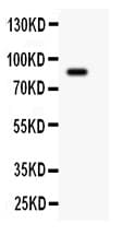 Polyclonal Rabbit anti-Human GSN / Gelsolin Antibody (aa580-782, IHC, WB)