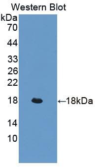 CD118 / LIF Receptor Alpha Antibody (aa641-790, Cy3)
