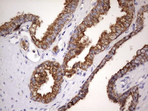 Acidic Cytokeratin Antibody (clone 7F10)