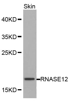 RNASE12 Antibody