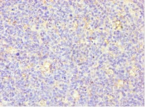 MSLN / Mesothelin Antibody (aa37-296)